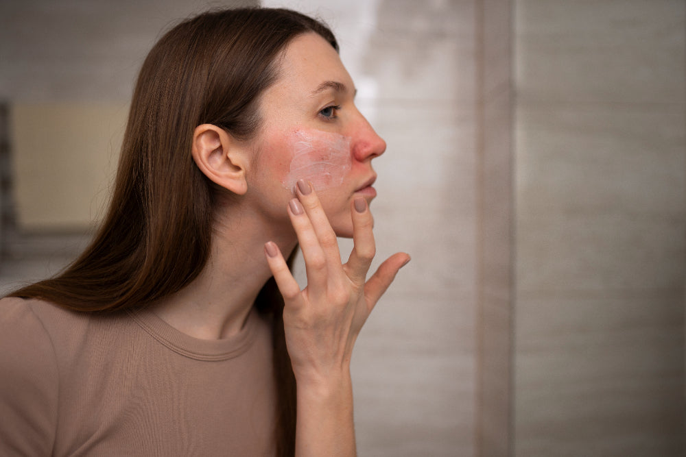 Skin Redness Solutions