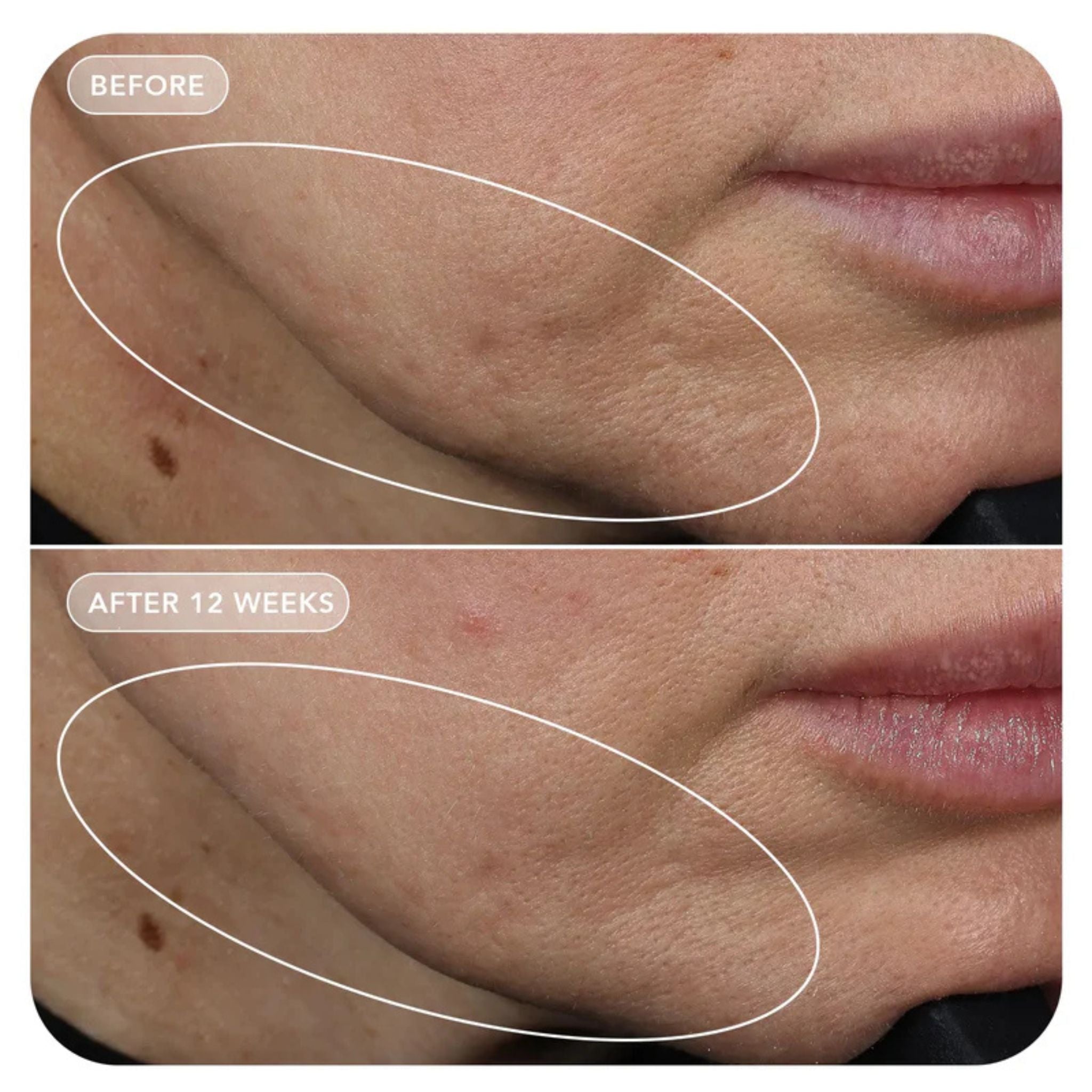 VOL.U.LIFT™ 4D Skin Rebound Complex