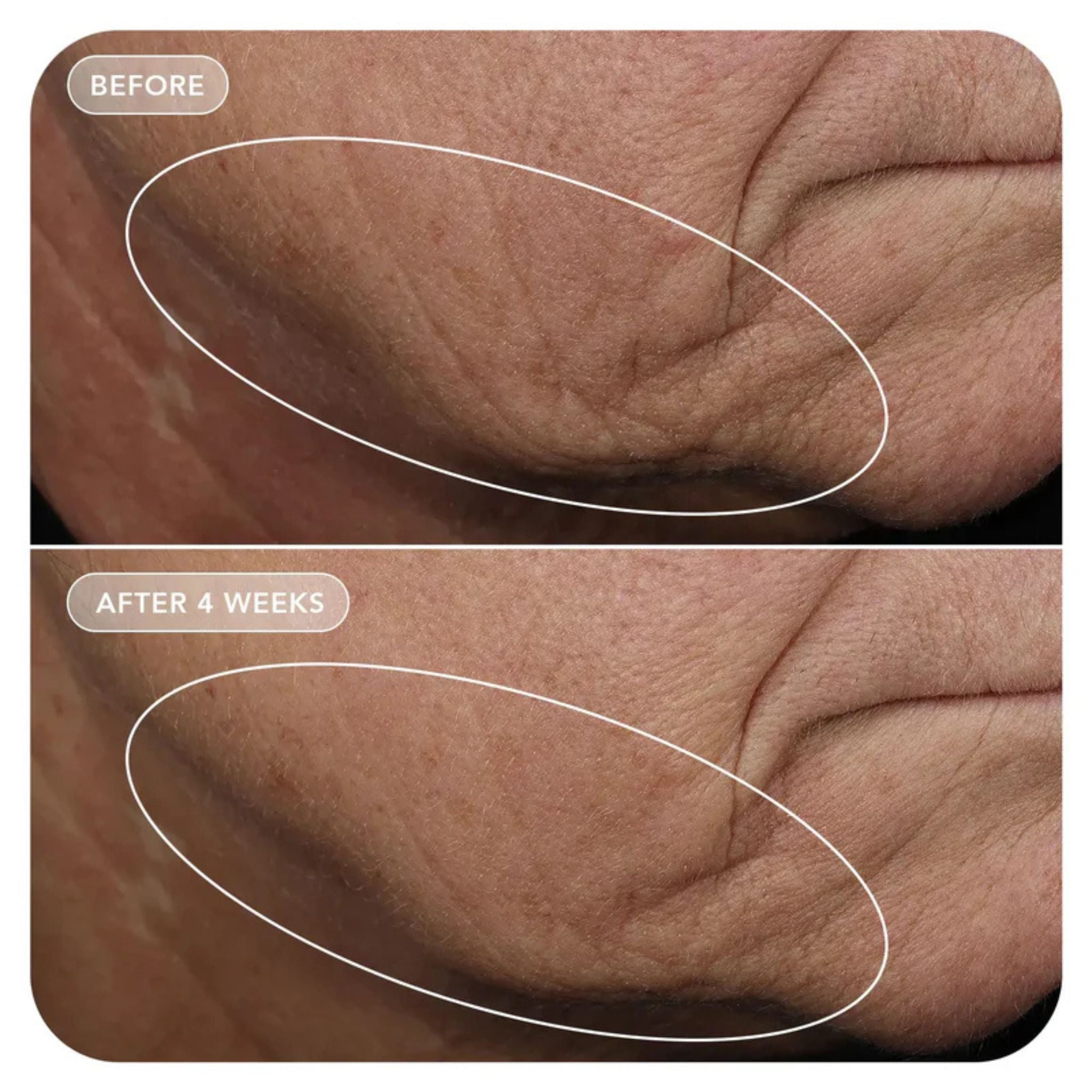 VOL.U.LIFT™ 4D Skin Rebound Complex