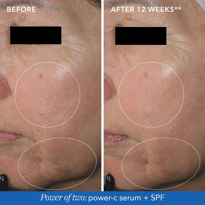 IMAGE MD® Restoring Power-C Serum