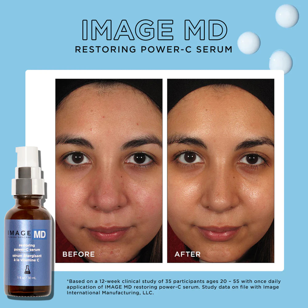 IMAGE MD® Restoring Power-C Serum shop Image Skincare Ireland online