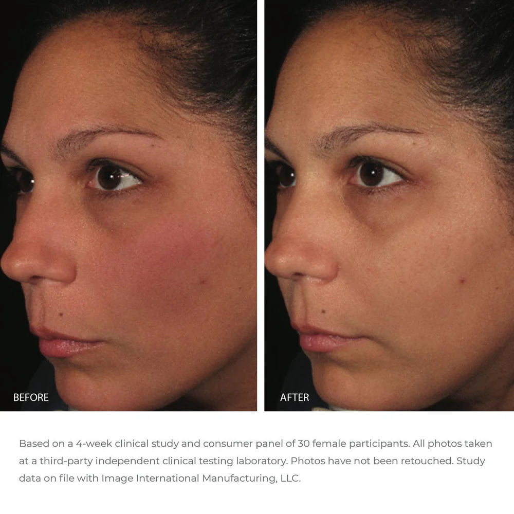 ORMEDIC Balancing Antioxidant Serum Image Skincare Ireland