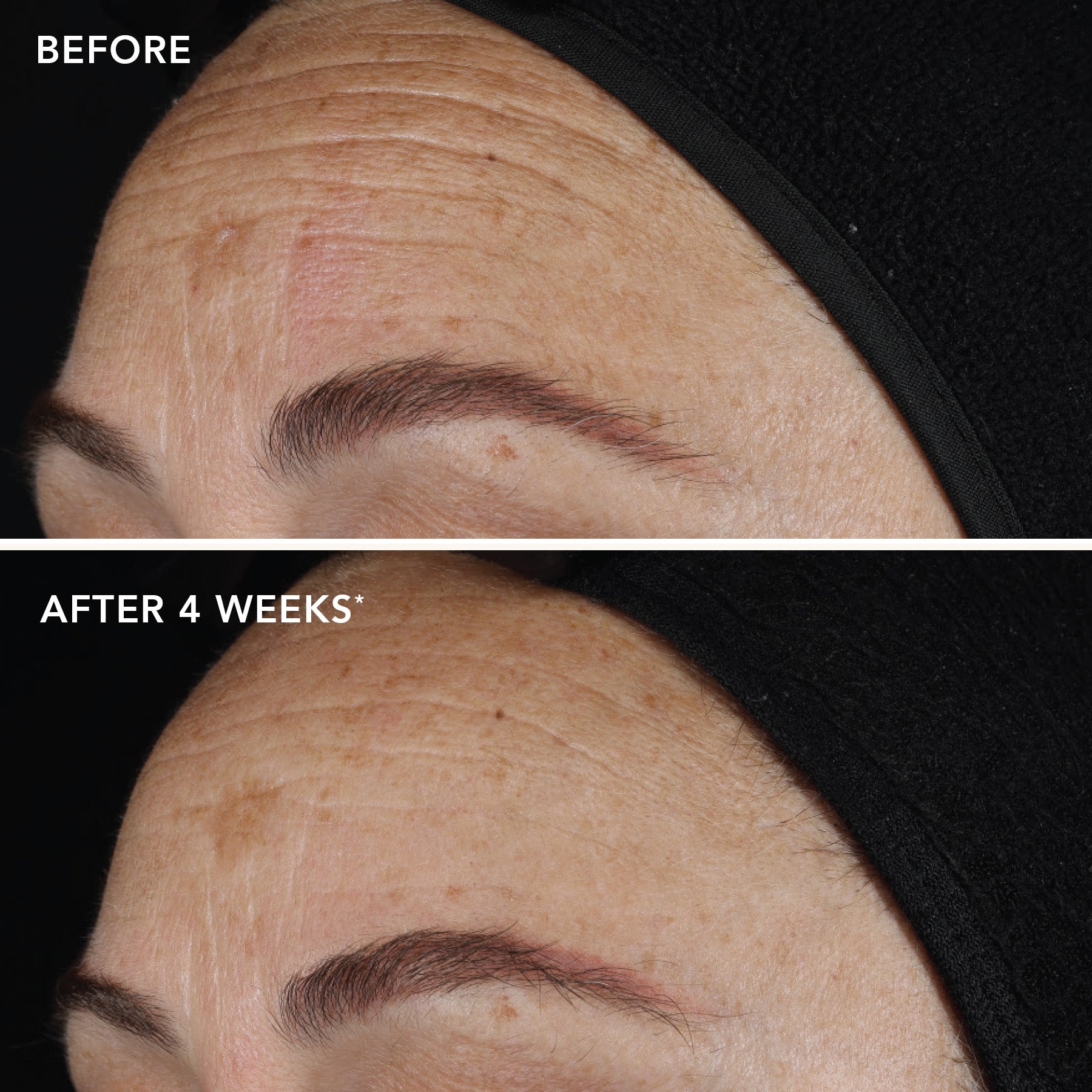 Image Skincare Ireland Retinol