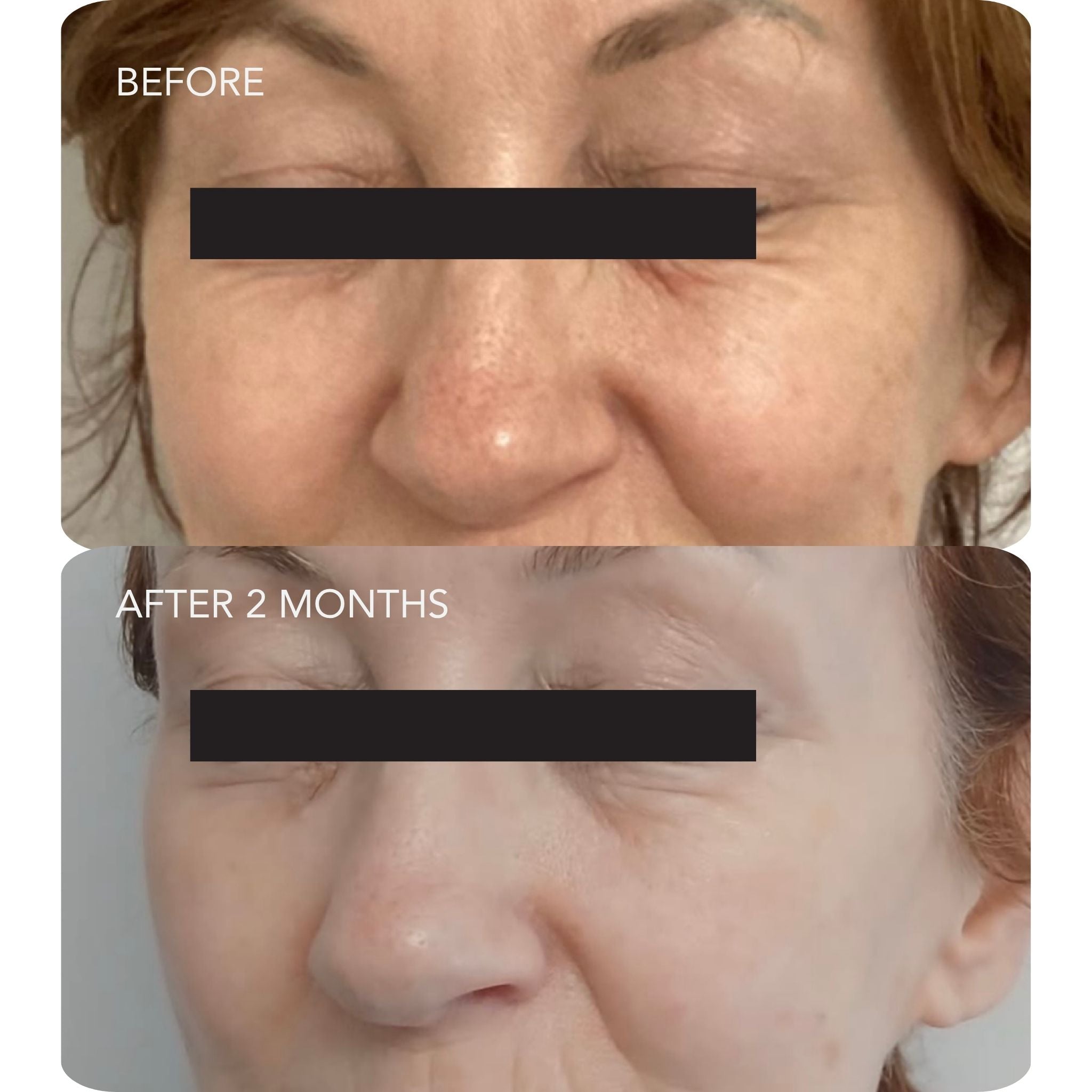 VOL.U.LIFT™ 4D Skin Rebound Complex
