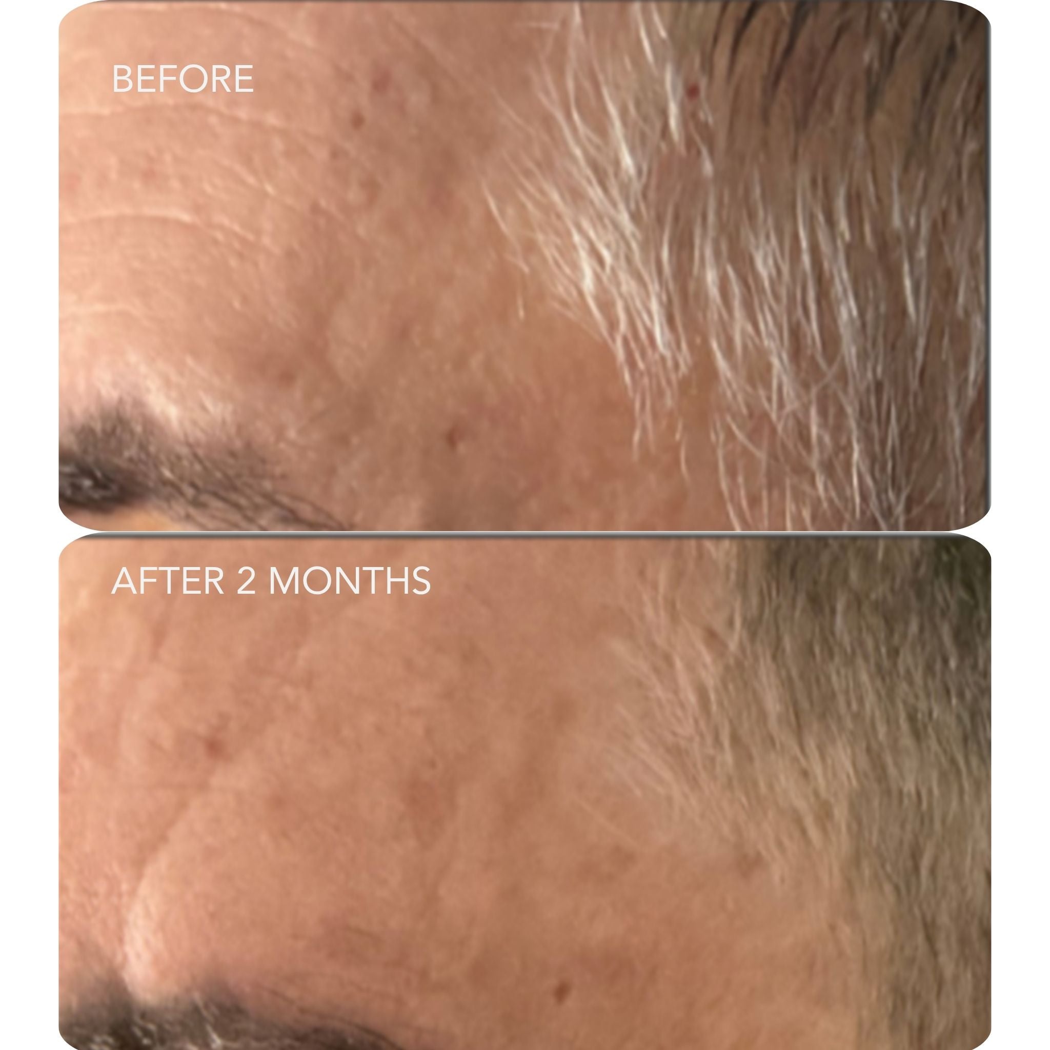 VOL.U.LIFT™ 4D Skin Rebound Complex