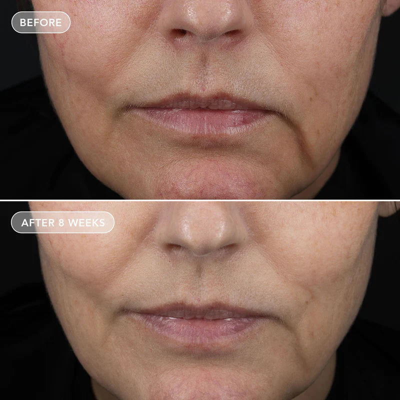 VOL.U.LIFT™ 4D Skin Rebound Complex