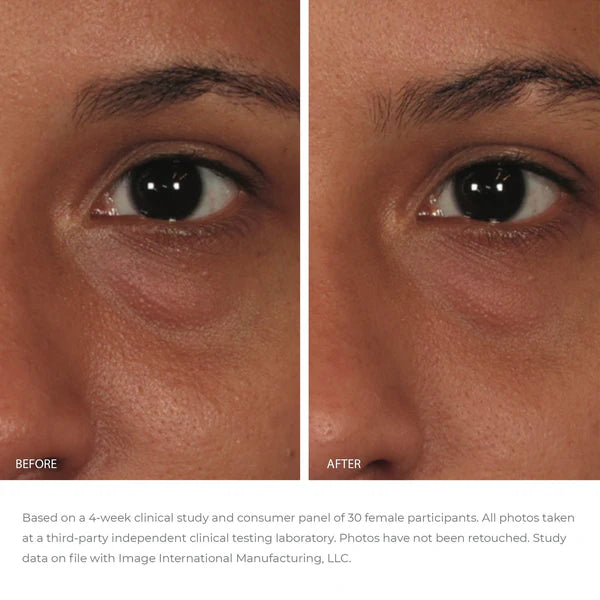 ORMEDIC Balancing Eye Lift Gel Irish stockist