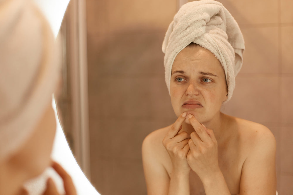 Dehydrated Skin