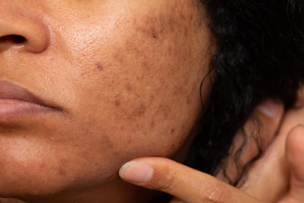 Vitamin C Skincare