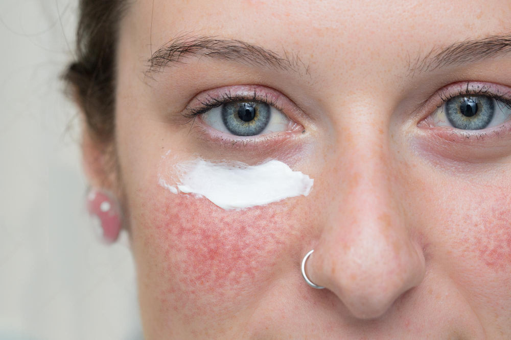 Caring For Sensitive Skin