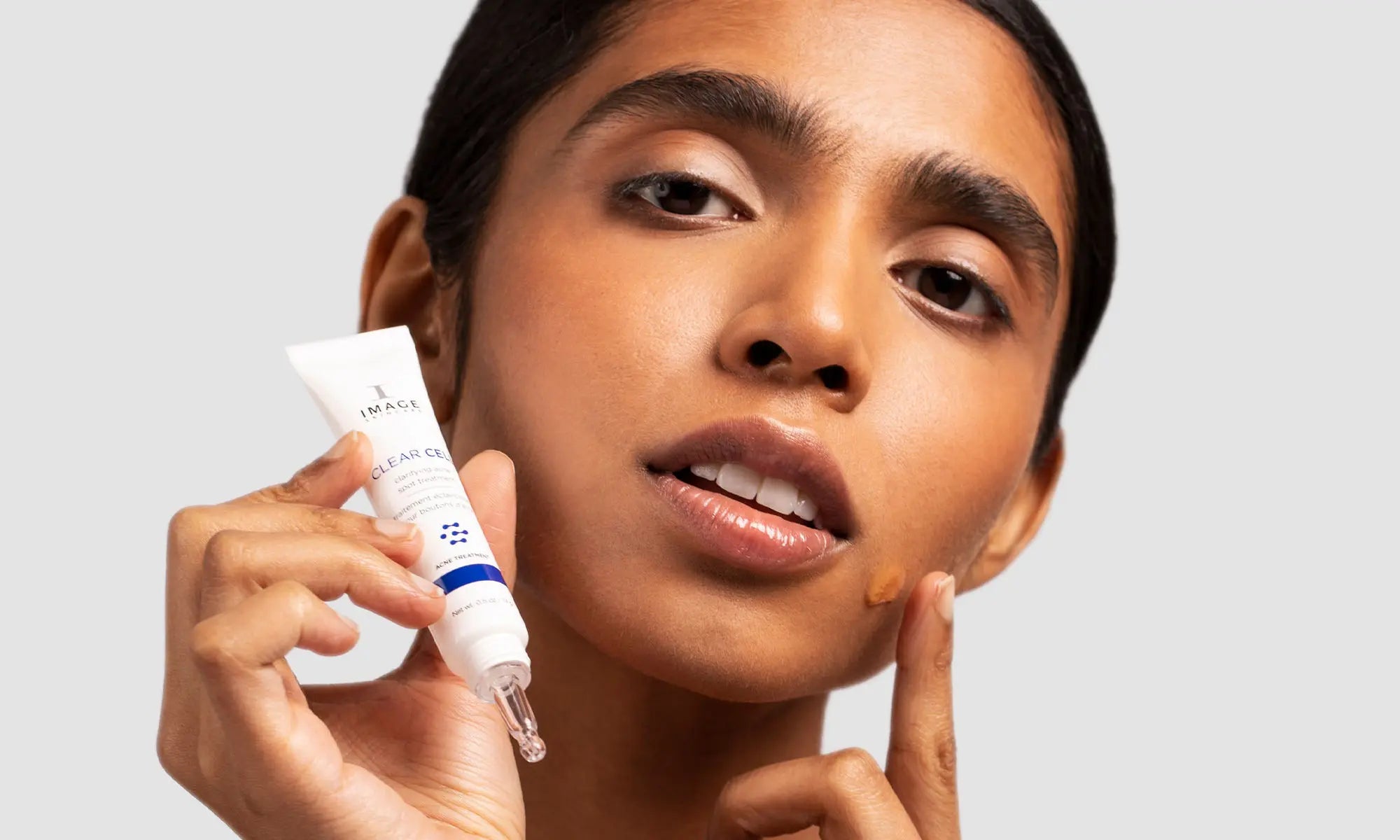 Acne Prone Skin