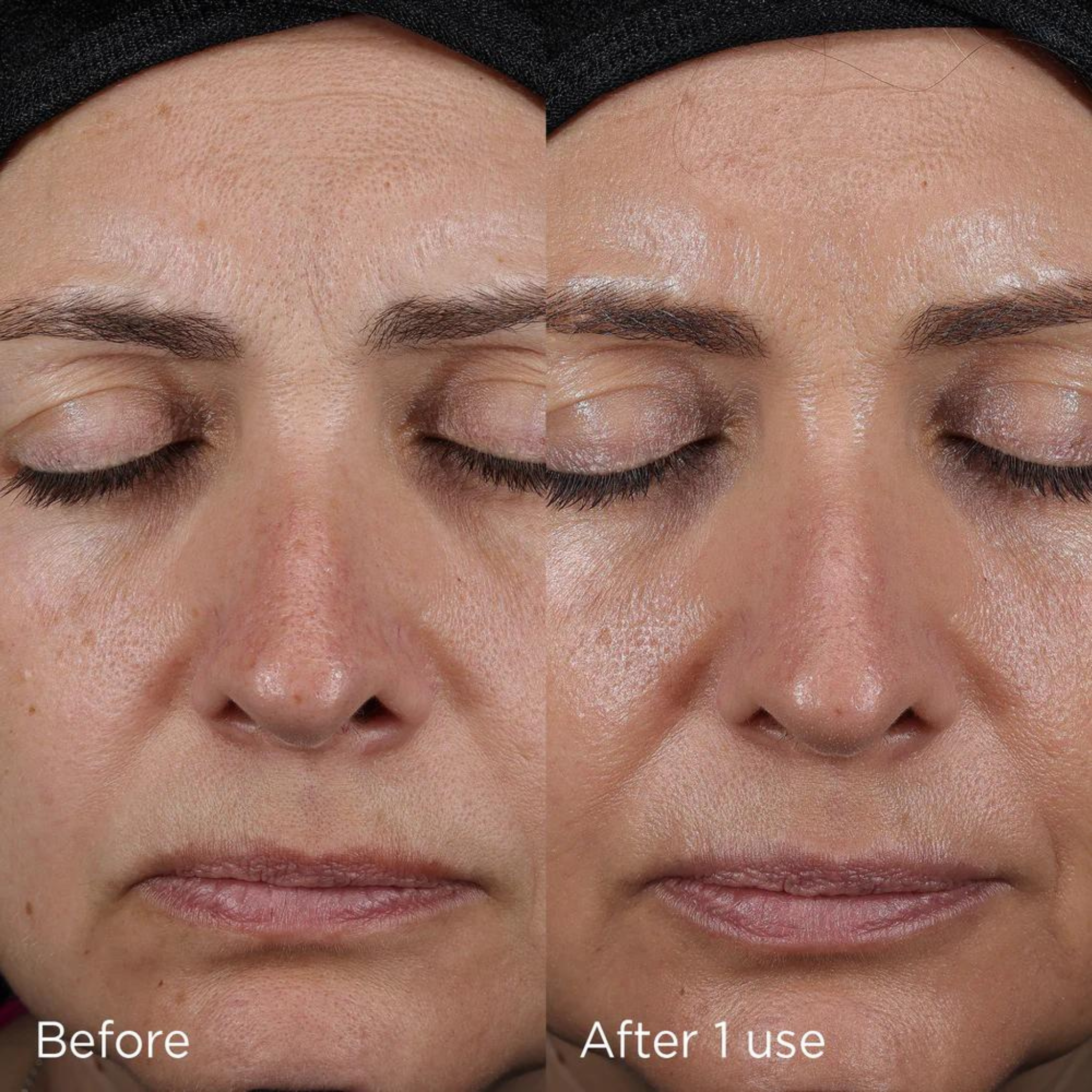 Before and after of 1 use of using the Advanced Smartblend SPF50+