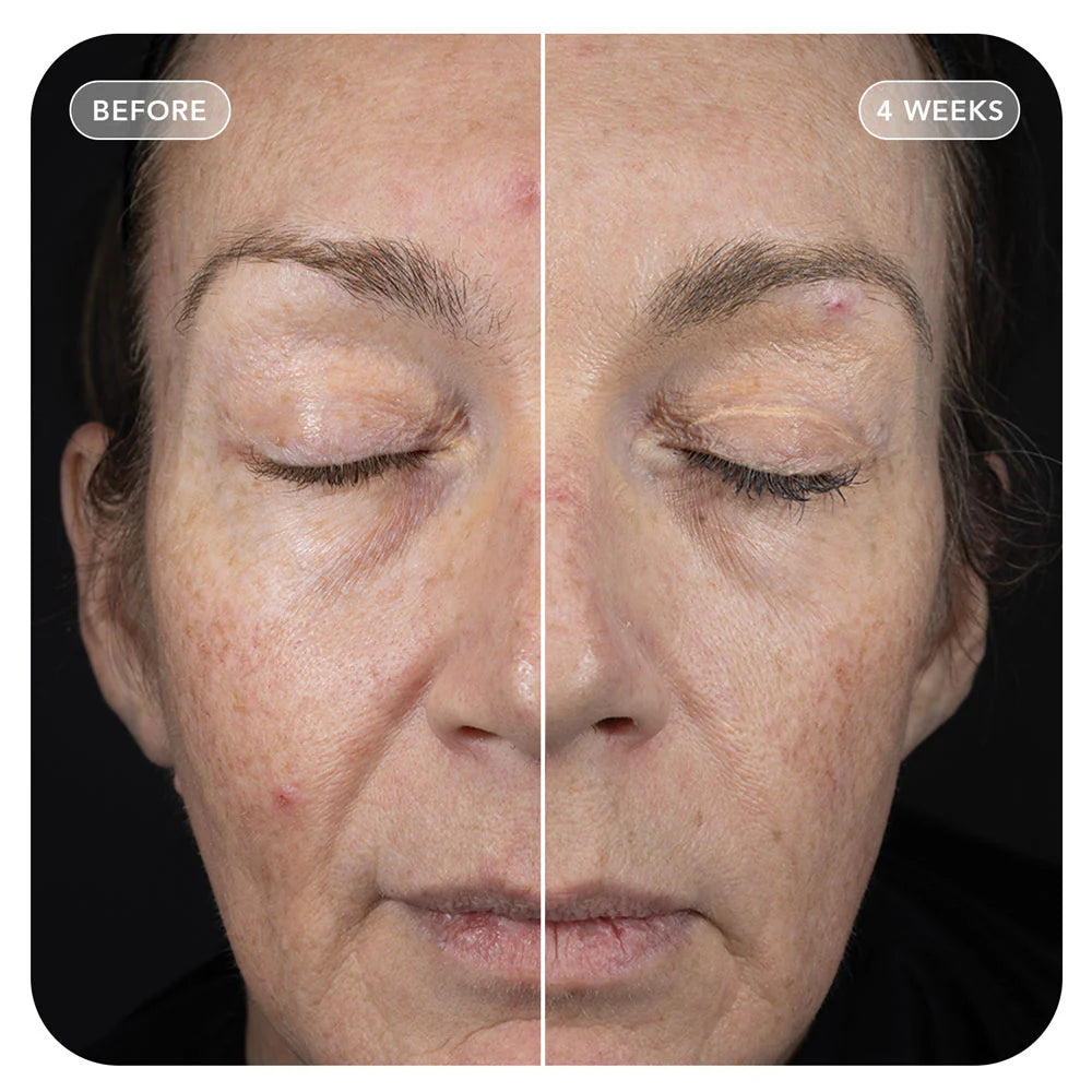 VOL.U.LIFT™ 4D Skin Rebound Complex